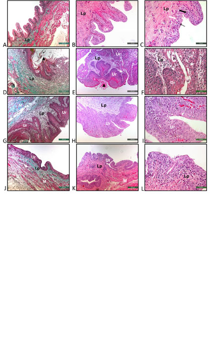 Effects of P-MAPA as immunomodulator on markers for energy metabolism in bladder cancer