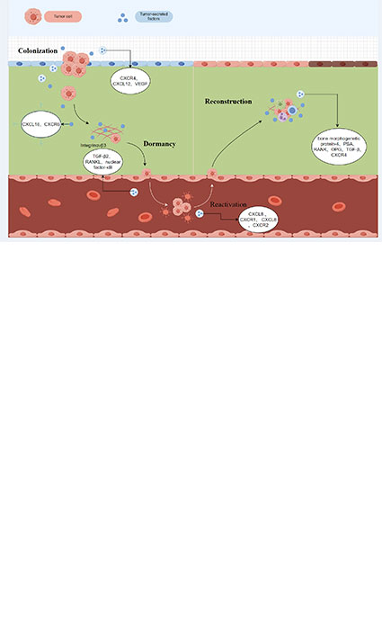 Research Progression in the Mechanism of Bone Metastasis and Bone-Targeted Drugs in Prostate Cancer