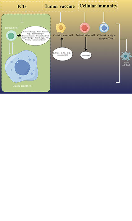 Research progress of perioperative immunotherapy for locally advanced gastric cancer